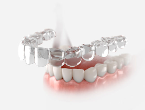 Bite for Life Subscription for Post Ortho Retainer Bi-Monthly